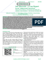 Extravasation Mucocele - A Case Report