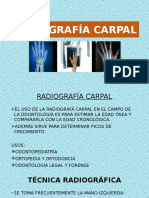 Radiografía Carpal