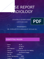 Case Report Radiology OA