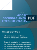 Histoplasmosis