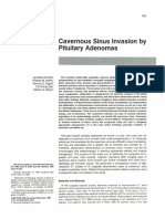 Cavernous Sinus Pituitary Adenoma