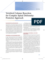Vertebral Column Resection For Complex Spinal Deformity: Posterior Approach