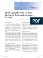 Short Segment "Bone-on-Bone" Fusion For Adolescent Idiopathic Scoliosis