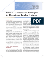 Anterior Decompression Techniques For Thoracic and Lumbar Fractures