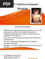 Chapter 10: Infectious Diseases: Measles