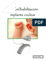 Implante Coclear