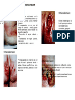 Úlceras Por Precion