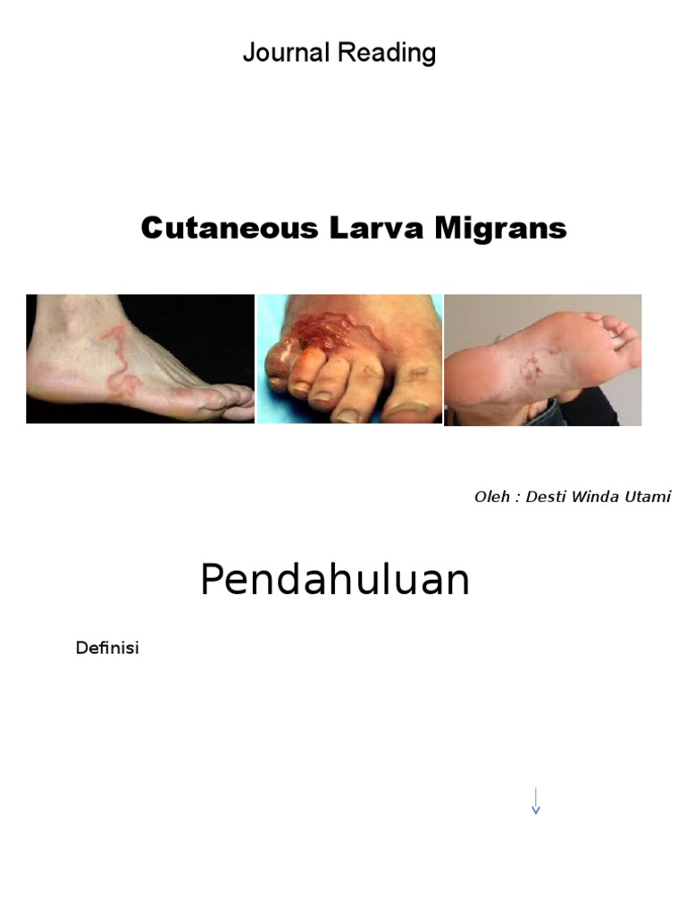 Cutaneous Larva Migrans: Gejala dan Pengobatan | PDF | Sains & Matematika