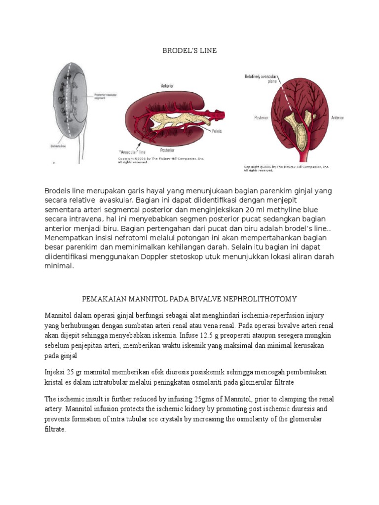 Garis Brodel dan Bivalve Nephrolithotomy | PDF
