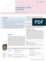 ECG Modificari de Repolarizare