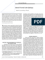 Epilepsia frontal dorsolateral