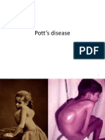 Pott’s Disease
