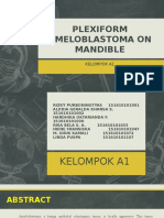 Plexiform Ameloblastoma On Mandible Fix