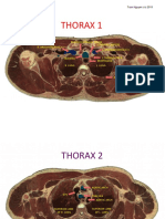 Thoracic Cross Sections