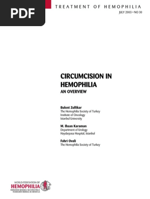 Circumcision In Hemophilia - 