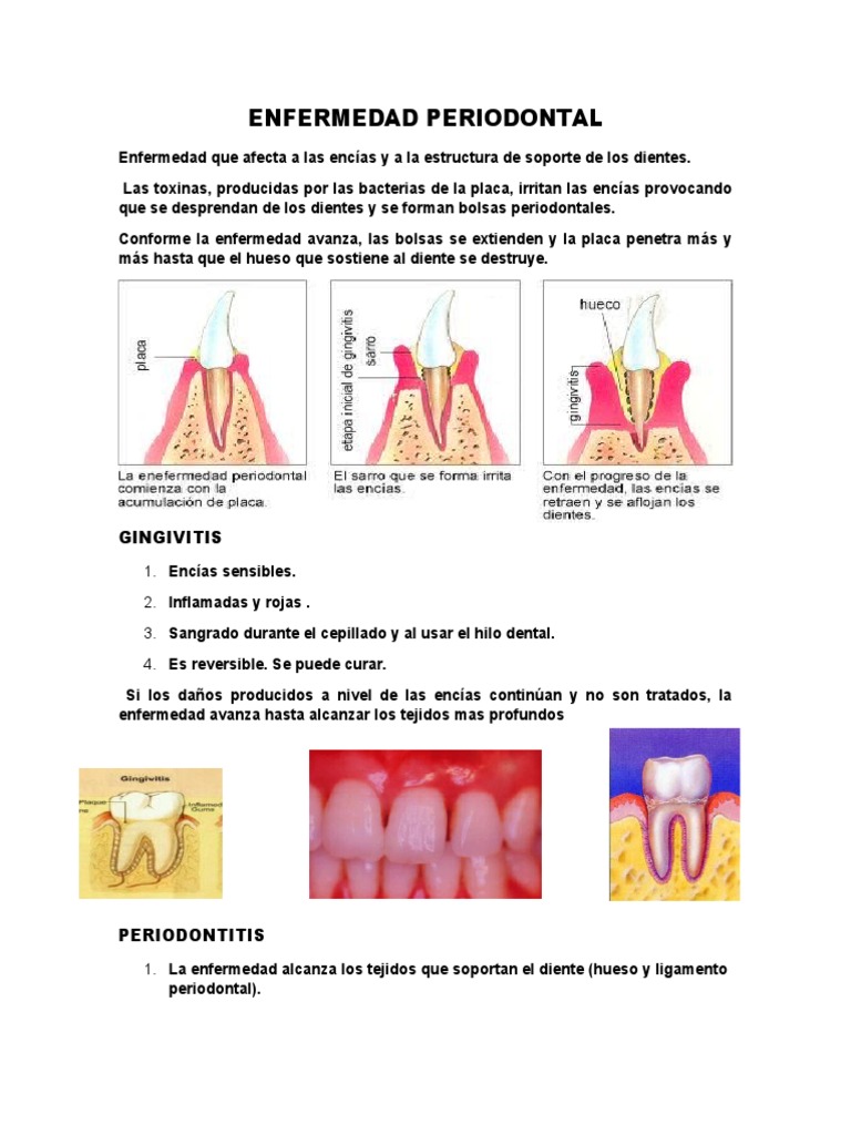 Enfermedad Periodontal | PDF | Diente humano | Antibióticos