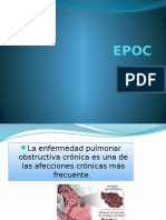 EPOC.pptx