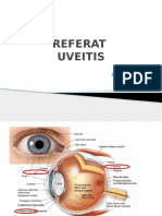 Uveitis Present