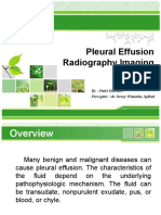 Pleural Effusion Radiography Imaging: L/O/G/O