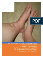 Edema and Homoeopathy