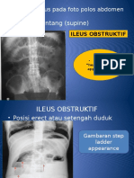 Radiologi Ileus Pada Foto Polos Abdomen