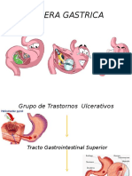Ulcera Peptica