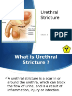 Urethral Stricture: Skdi 2