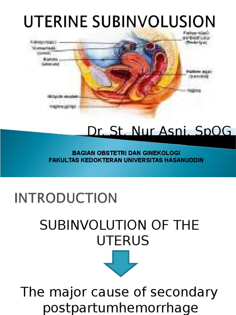 Dr Nur Asni Uterine Subinvolusion Pdf Uterus Antibiotics