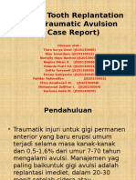 Delayed Tooth Replantation After Traumatic Avulsion