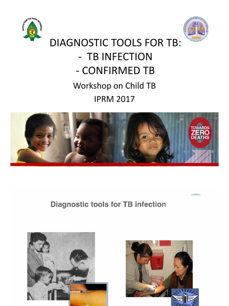 Diagnostic Tools For TB: - TB Infection - Confirmed TB: Workshop On ...