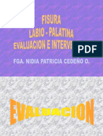 Fisuralabiopalatinaint.ex (Leido)
