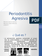 Periodontitis Agresiva