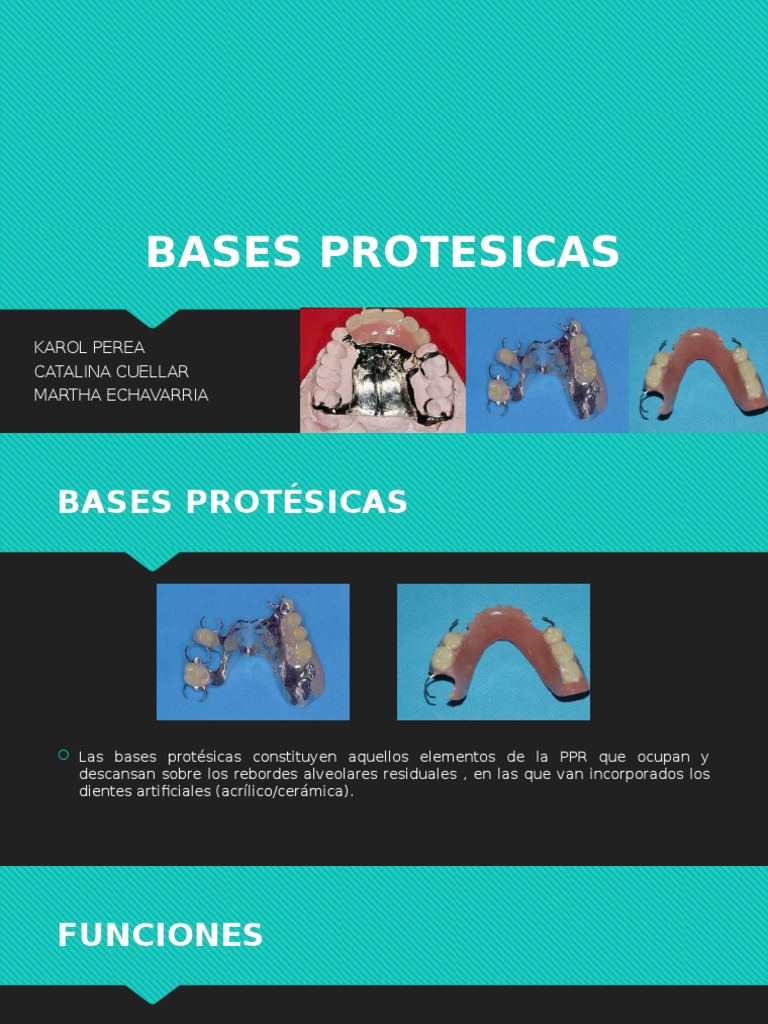 Diseño y Función de Bases Protésicas | PDF | Dentadura postiza | Diente ...