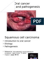 Oral Cancer Etiology and Pathogenesis