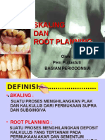 Skaling Dan Root Planing (12)