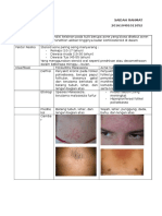 Acne Steroid Vs POF