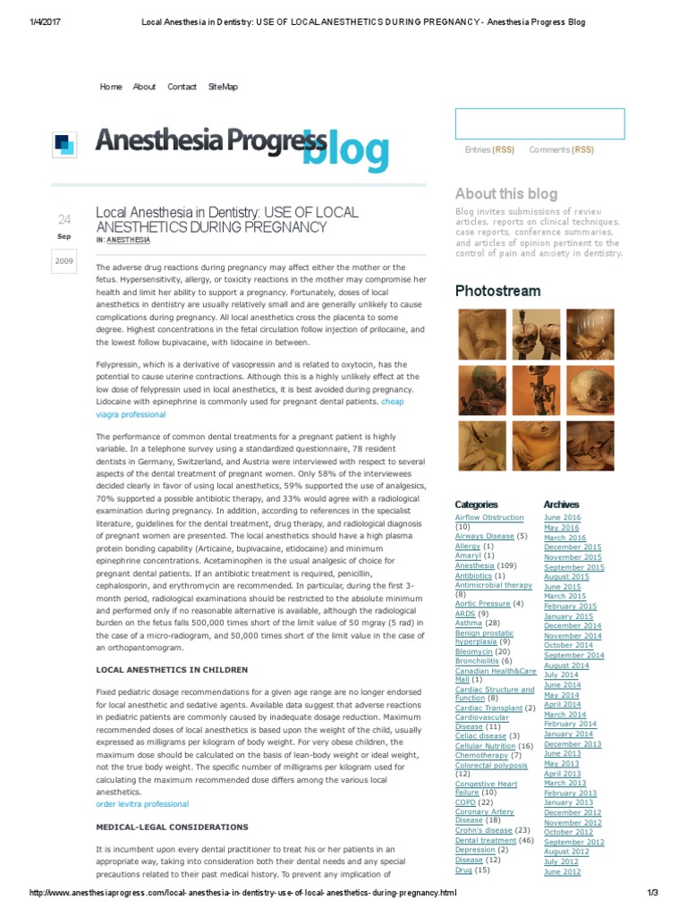 Local Anesthesia in Dentistry Use of Local Anesthetics During