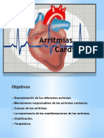 Las arritmias cardiacas: clasificación, causas y tratamiento