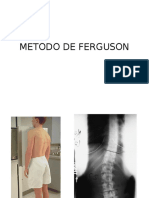 Metodo de Ferguson