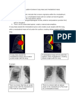 Radiographyc Pattern Between Lung Mass and Mediastinal Mass