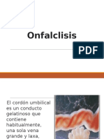 Onfaloclisis