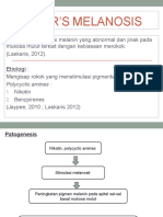 Smokers Melanosis Icha