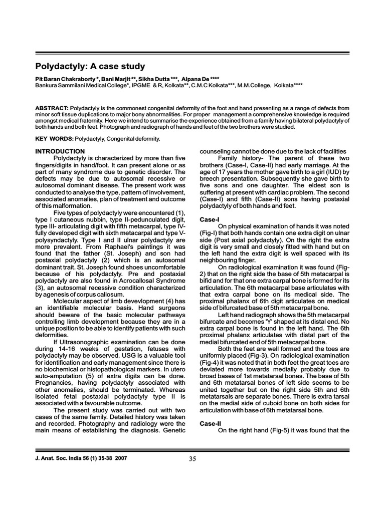 Polydactyly down syndrome picture