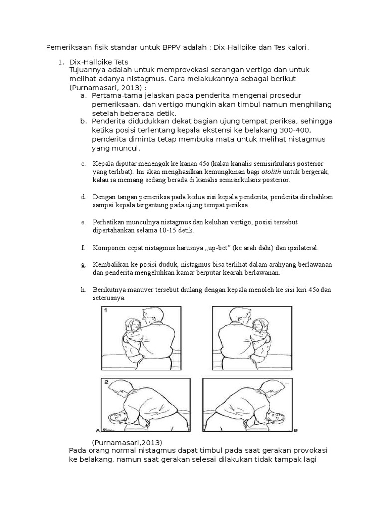 BPPV | PDF