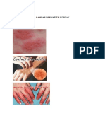 Pendriat Dermatitis
