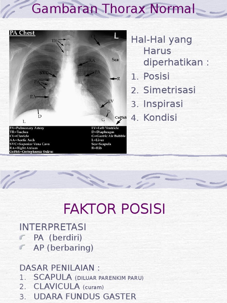 Gambaran Foto Thorax Normal | PDF | Thorax | Vertebra