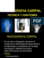 Radiografia Carpal