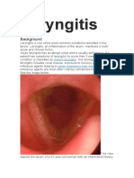 Laryngitis