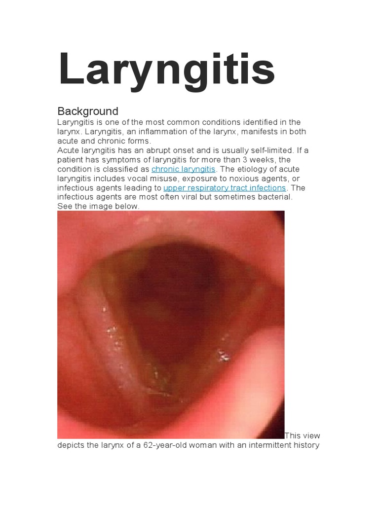 Laryngitis PDF Common Cold Pneumonia