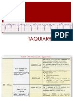 Clase 5- Taquiarritmias 2015